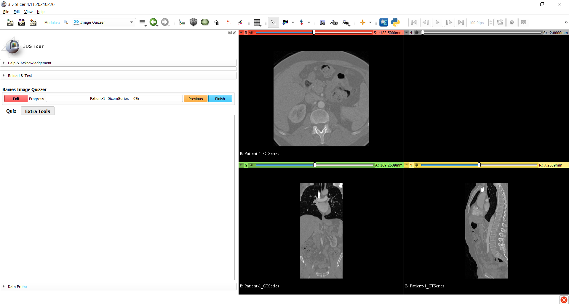 Loading dicoms - Image Quizzer Documentation