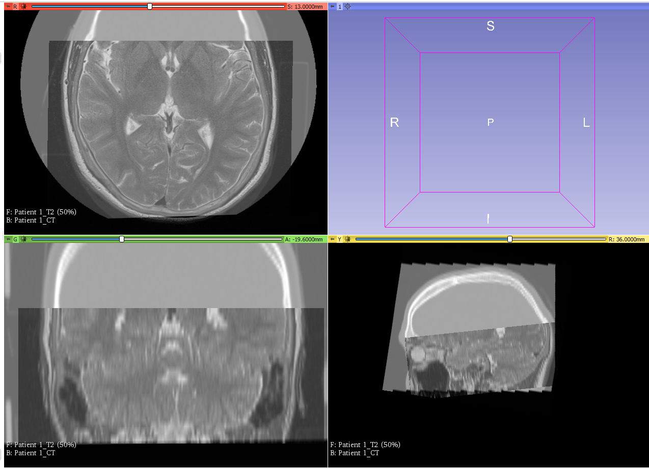 After image repositioning