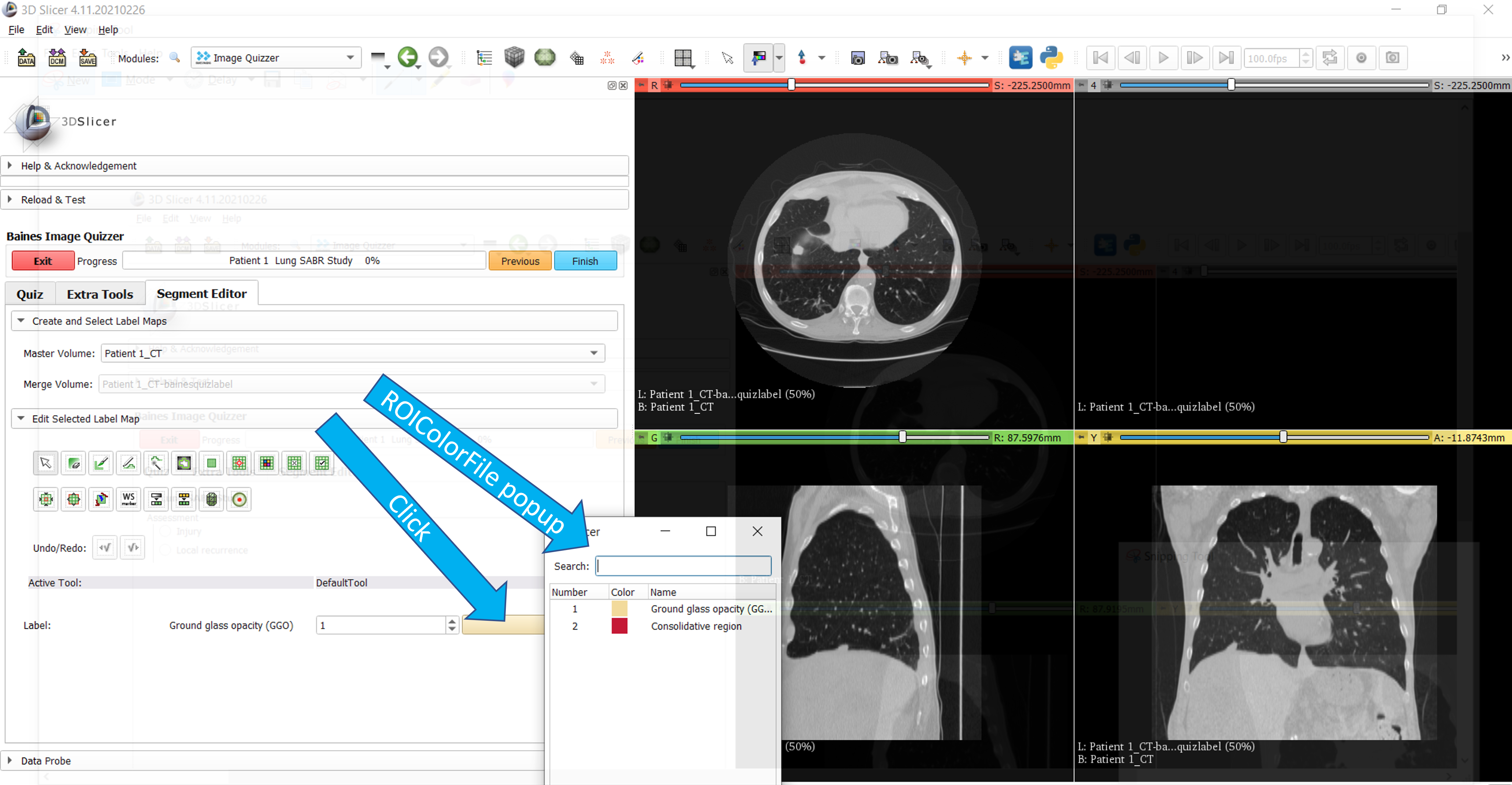 Segment color options