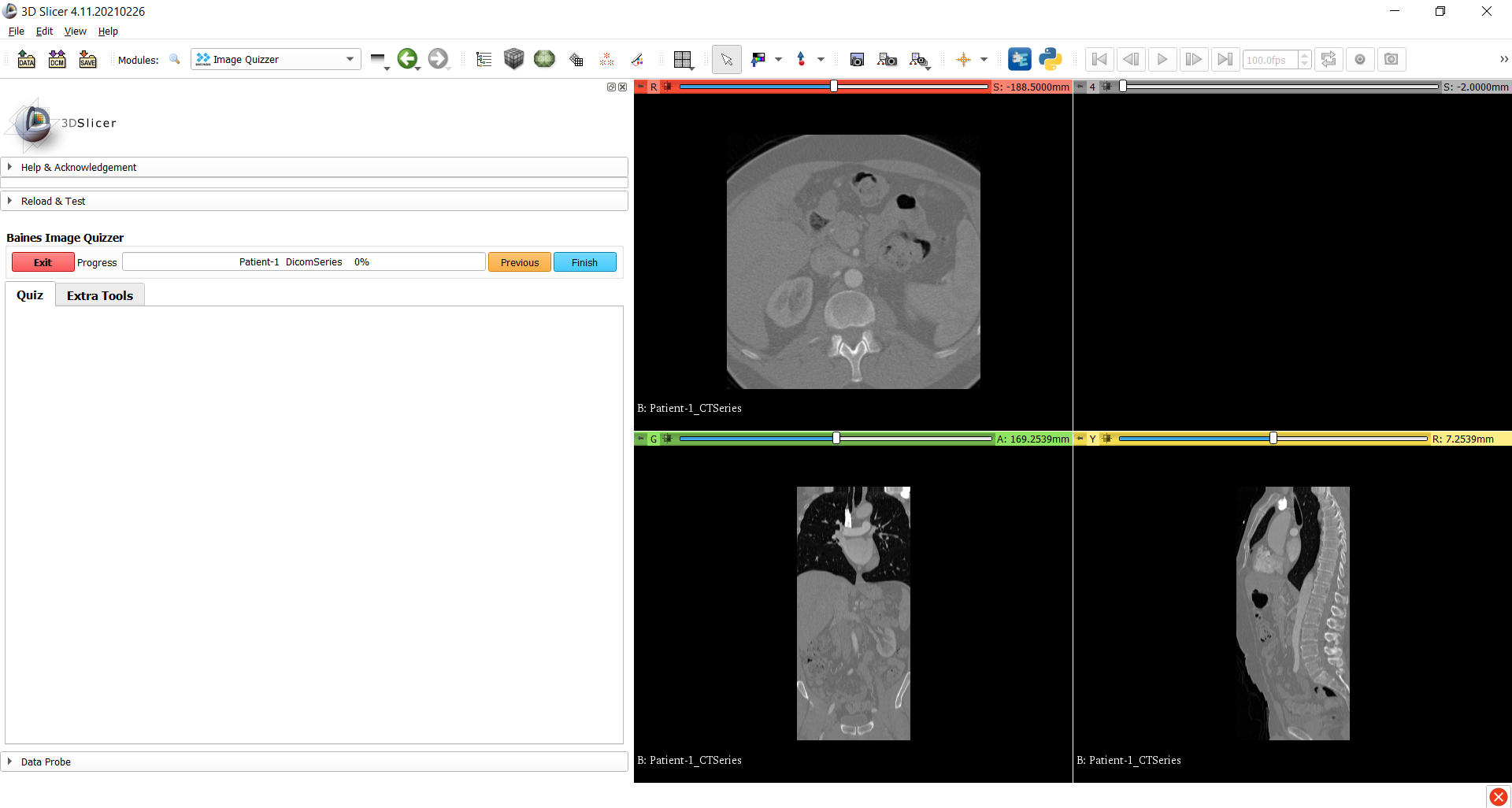 Loading dicom data